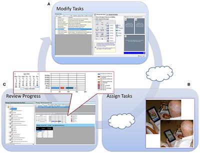 Refining an Asynchronous Telerehabilitation Platform for Speech-Language Pathology: Engaging End-Users in the Process